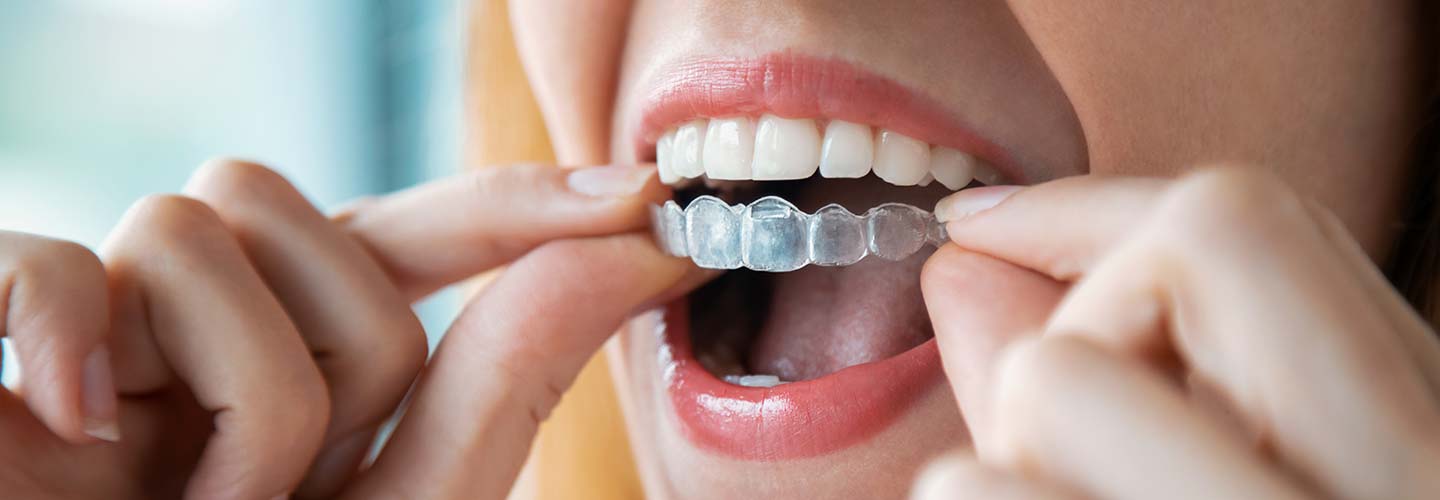 IzziDentalCare-1226447065